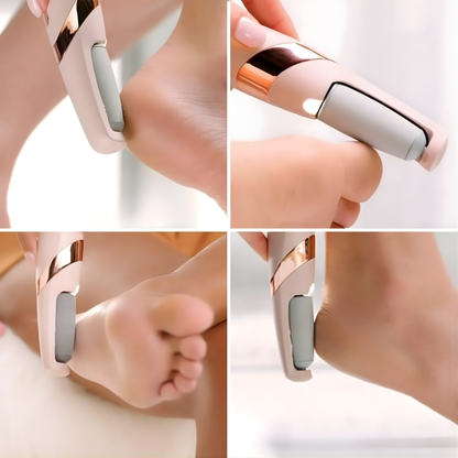 PediFeet – električni pedikir aparat